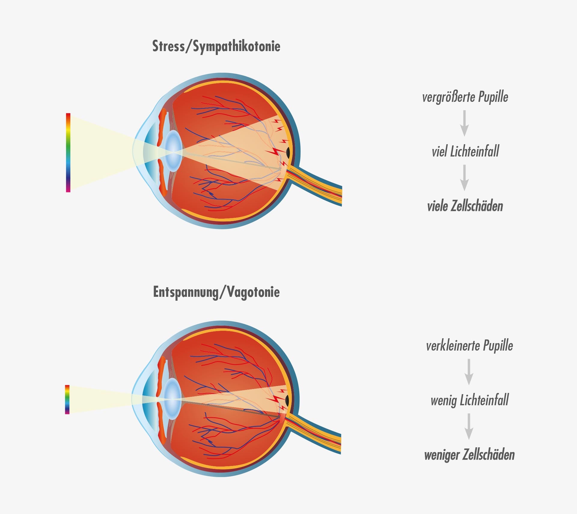 AGE -Related_Makuladegeneration_amd_Lichtinfall_ins_Auege