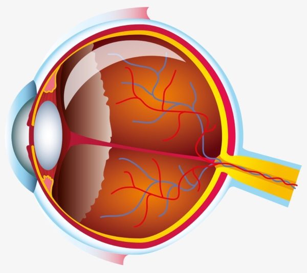 Aye grafic, Age-related macular degeneration (AMD)