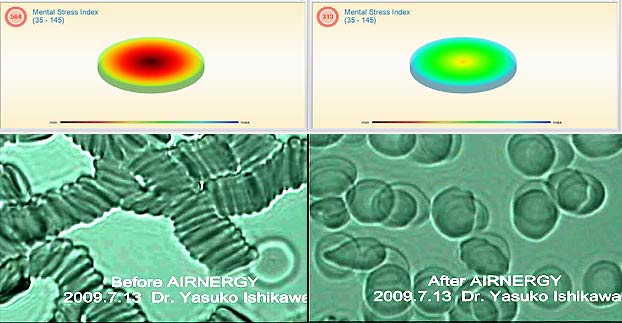 Virus bekämpfen, waldbaden, atmen, zellatmung, regulieren, healing your self, Regeneration, Atmen