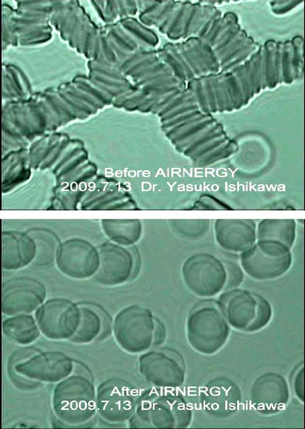Changes on blood cells with Airnergy Foto: Changes on blood cells with Airnergy
